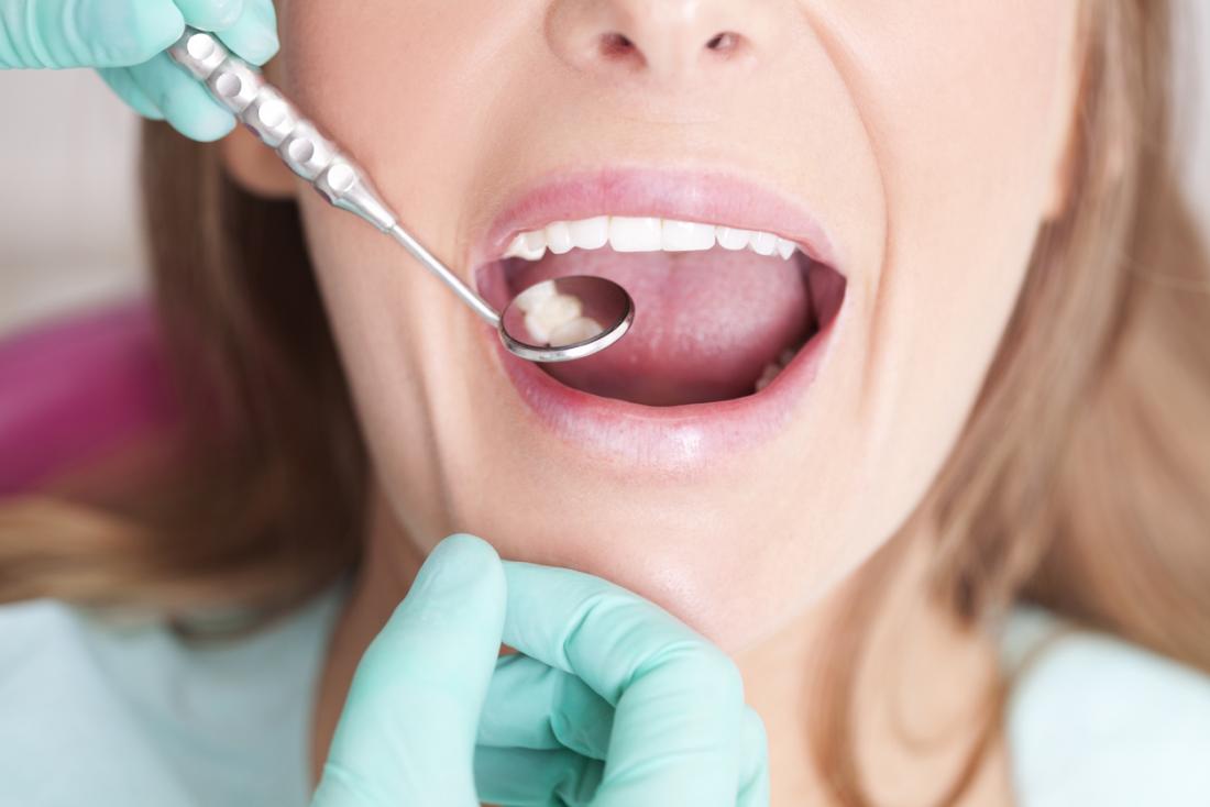 A dentist checking a woman's teeth